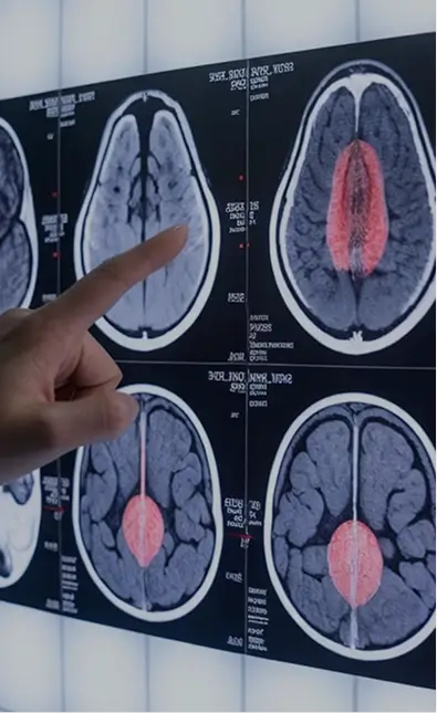 Traumatic Brain Injury Lawyers Get Higher Settlement Offers From the Insurance Company